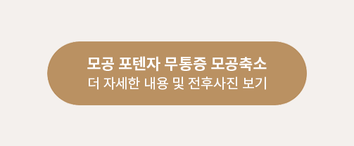 포텐자 링크